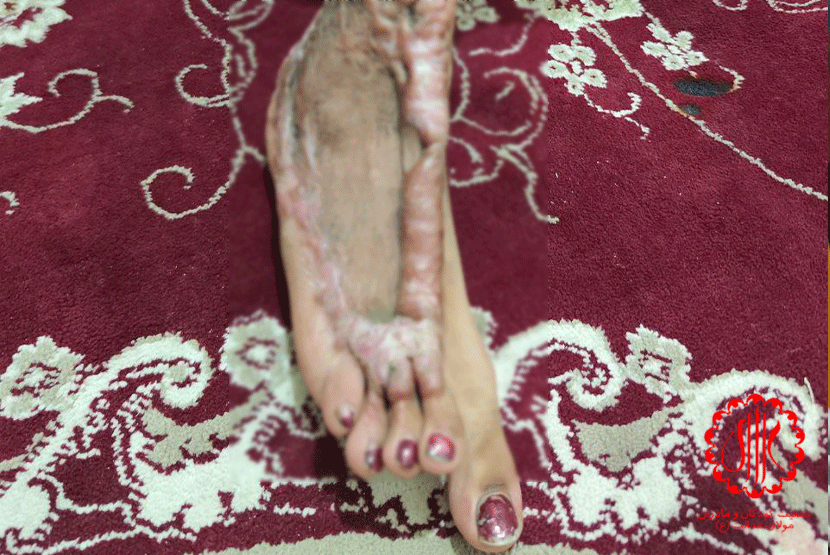 الهام